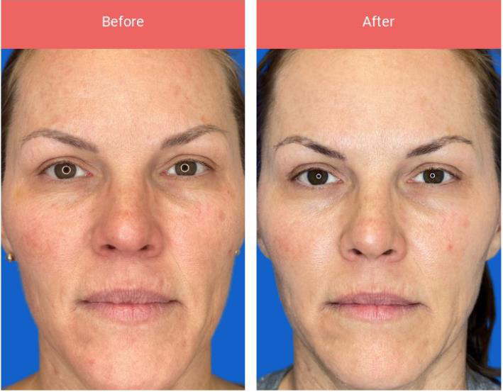 GME FlexSys | Modulair laser platform