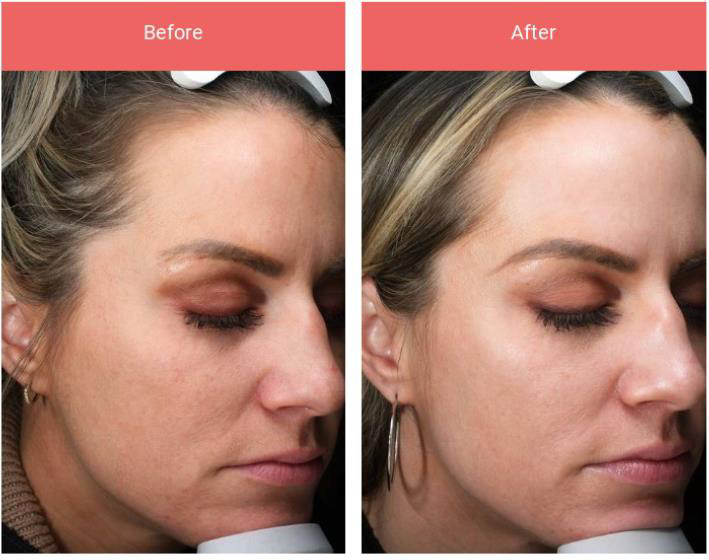 GME FlexSys | Modulair laser platform