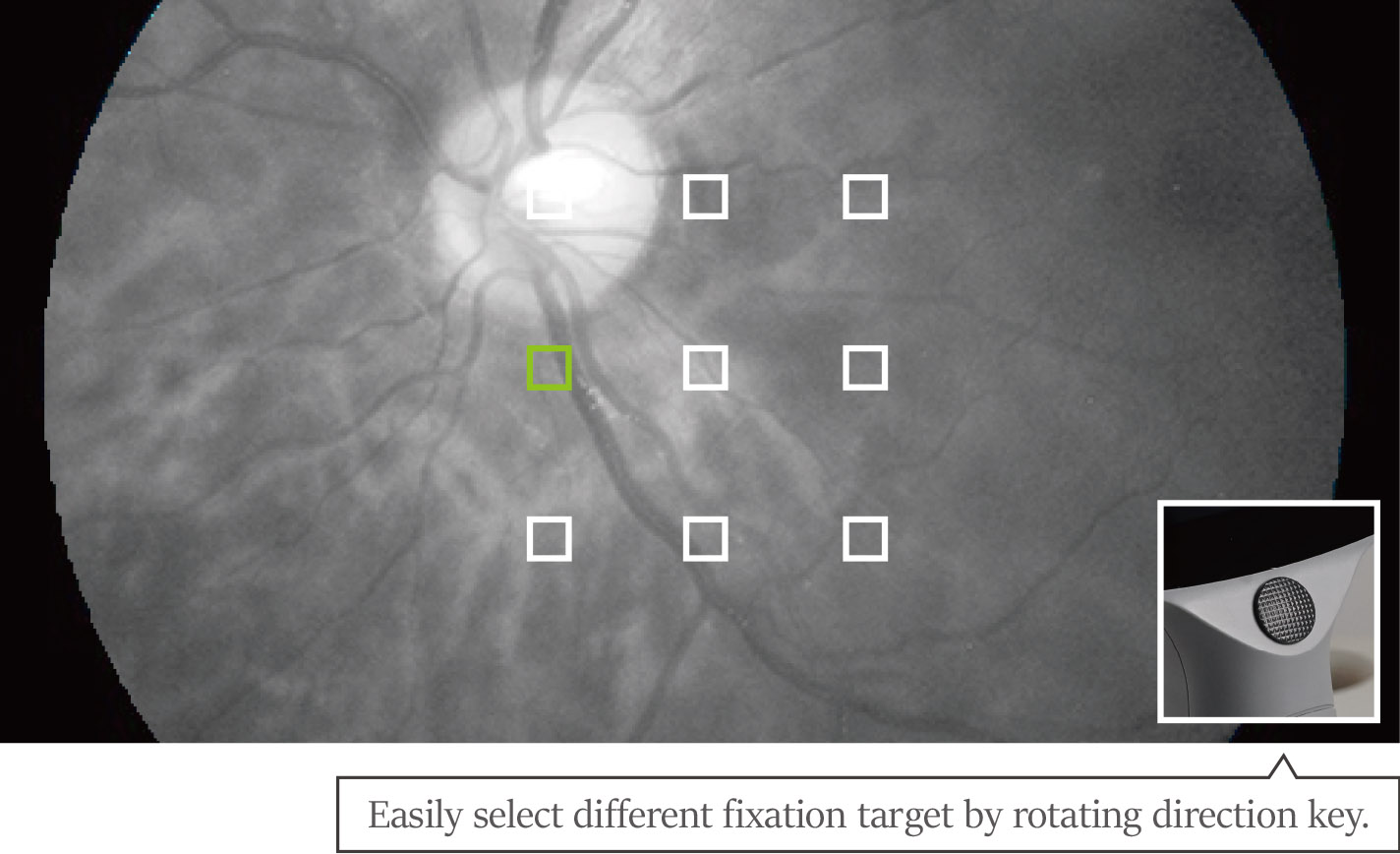 FC161 Hand-held Funduscamera