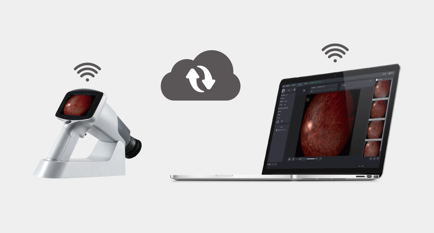 FC161 Hand-held Funduscamera