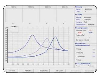 tympanometer TYMP 4000-M