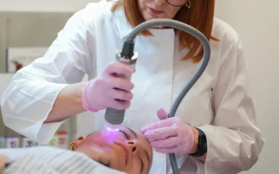 Wat kunt u verwachten van een behandeling voor huidverstrakking in het gezicht?