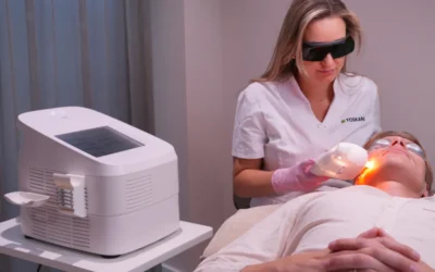 Hoe werkt IPL voor pigmentvlekken?